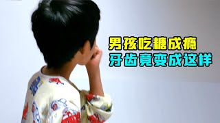 男孩吃糖成瘾，每天睡前都要吃3颗糖，牙齿竟变成这样！