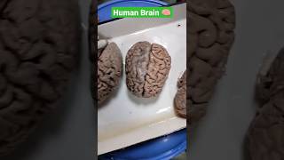 Human Brain 🧠😍#Mbbs🥼#Shkmgmc 🏥#Human#Brain🧠😍#Anatomy📚🥰#Dissectionhall❤️