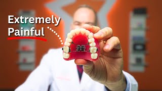 99% of Parents Choose Expanders To Fix A Child’s Teeth and It’s WRONG