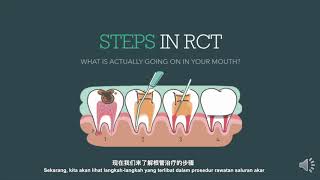 ROOT CANAL TREATMENT (RCT) and Post \u0026 Core 3