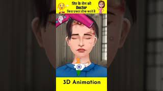 सिर में इंफेक्शन 3D Animation 😳 #shorts #short #knowledge #shortvideo #viralshort