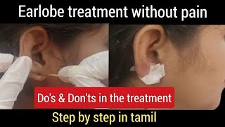 Earlobe surgery without pain 👂// earlobe surgery//earlobe treatment in parlour