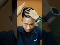 Jangan Cabut Rambut Uban!! Ini Solusi Yang Tepat!!