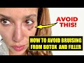 How to Prevent Bruising from Botox and Filler- DO THIS Before you get Facial Injections