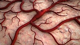 Blood Clots in Veins \u0026 Arteries |Cause of a heart attack |