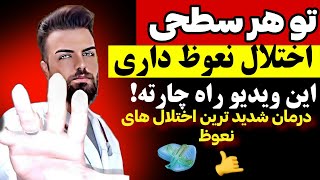 درمان اختلال نعوظ در خانه بدون دارو | Erectile Dysfunction Treatment at Home without Medication!