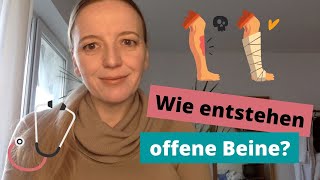 Was sind offene Beine? Und wie therapiert man sie? FRAG SILKE