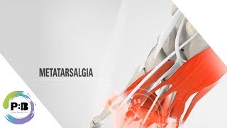 Why Orthotics Can Help With Metatarsalgia / Cure Foot Pain / Foot Inflammation / Joint Pain