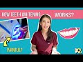 How DOES TEETH WHITENING Actually works!