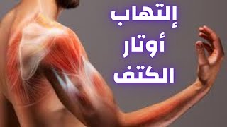 إلتهاب اوتار الكتف ، الاسباب ، الاعراض| علاج التهاب اوتار الكتف| دكتور احمد حسن جمعه