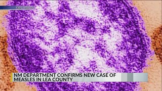 Measles count rises to 9 in Lea County