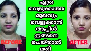 എത്ര വെളുക്കാത്ത മുഖവും വെളുക്കാൻ ആപ്പിൾ ഇങ്ങനെ ചെയ്‌താൽ മതി/Apple Face Pack For Glowing Skin