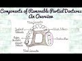 Components of Removable Partial Dentures - An Overview