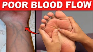 13 Common Signs You Have Poor Blood Circulation Without Even Knowing It