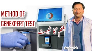 GeneXpert For Tb Test | Sputum test