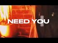 Mattilo - Need You (Visualiser By MVT Visuals)