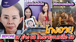 67 ย่าง 68 โกงอายุจนเหลือ 50 ปี ใครจะไปจำได้เนี่ยยย ธีรพรคลินิก หมอชลธิศ