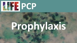 Prophylaxis for Pneumocystis