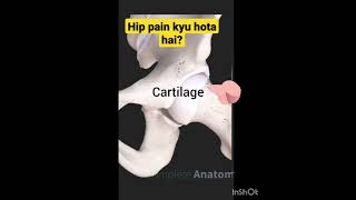 Hip pain kyo hota hai.#hippainrelief# Dr. Shumaila Ashraf