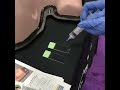 fine needle aspiration practicing on a dummy