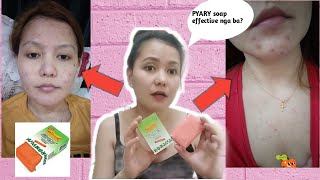 PYARY TURMERIC SOAP HONEST REVIEW | ANTI-ACNE + WHITENING SOAP