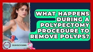 What Happens During A Polypectomy Procedure To Remove Polyps? - Colon Health Channel