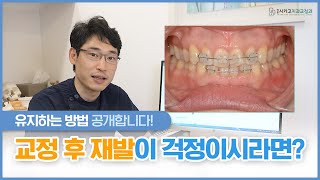 교정과 전문의가 말해주는 교정 후 재발 가능성 및 유지 방법