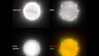 Actin Ezrin and Cortactin stainings on Retraction fibers during mitosis