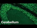 Immunofluorescence: Autoantibodies against basic, RNA-binding proteins of the neuronal cell  nuclei