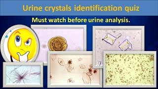 Urine crystal identification quiz(Check your identification ability..)