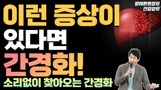 이런 증상이 있다면 간경화! (소리없이 찾아오는 간경화) [방태환원장의 건강강의]