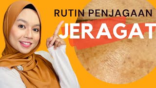 Rutin Penjagaan KULIT JERAGAT (Step by step)