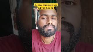 37 day use adivasi hair oil #adivashioil #viral #shortvideo #oil #adivasi