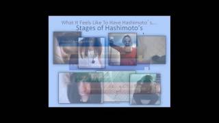 Isabella Wentz’s Insightful Talk on Hashimoto’s: Hypothyroidism, Symptoms, Diagnosis, and Treatment