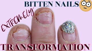 EXTREME BITTEN NAIL TRANSFORMATION | APPLYING WITH MY NON DOMINATE HAND