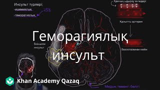 Геморагиялық инсульт/Медицина/Қазақ Хан Академиясы