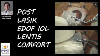 post lasik EDOF iol lentis comfort.Dr Sourabh Patwardhan Live Cataract surgery.  call 9220001000