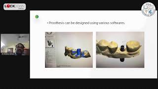 Digital Workflow in Dental Implantology