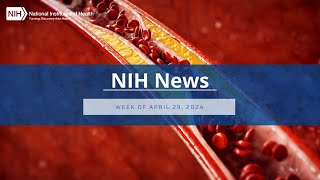 NIH News – Week of April 29, 2024