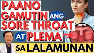 Paano Gamutin ang Sore Throat at Plema sa Lalamunan.- By Doc Willie Ong (Internist and Cardiologist)