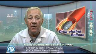 Heart Minute | Drug-eluting Balloon Rx in PAD