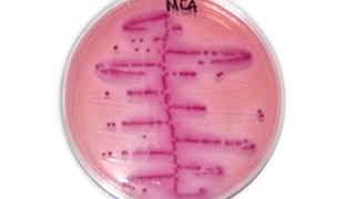 Uropathogenic-Escherichia-coli on MCA