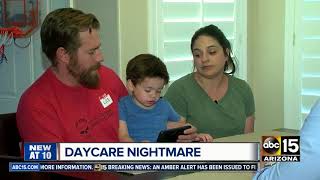 Parents outraged after child bitten multiple times at Glendale daycare