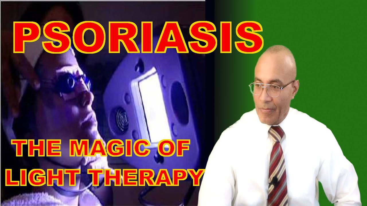 Psoriasis Treatment (How Light Therapy Works) - YouTube