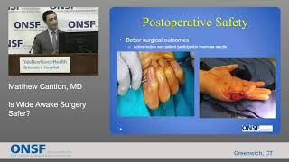 ONSF 2018 Conference: Matthew Cantlon MD