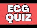 ECG Quiz Collection