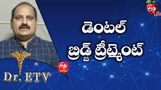 Dental Bridge Treatment | డెంటల్ బ్రిడ్జ్ ట్రీట్మెంట్ | Dr.ETV | 26th January 2022 | ETV Life