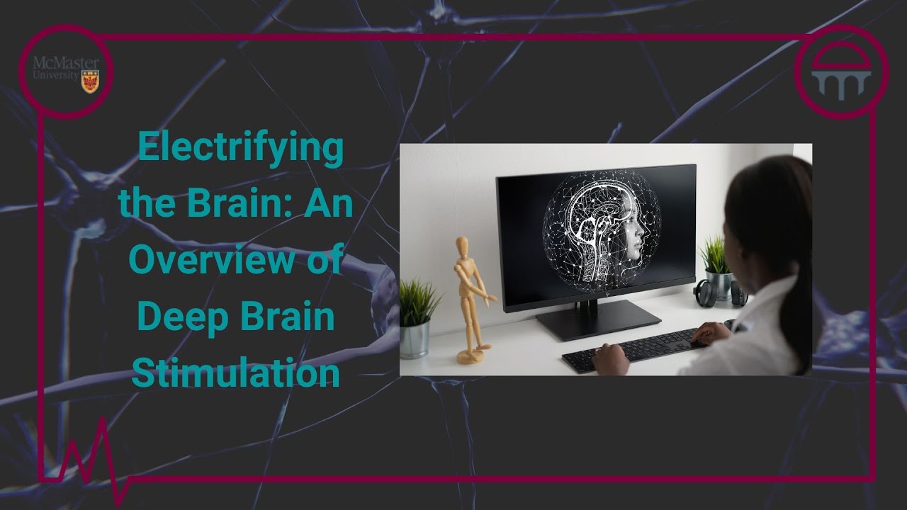 Electrifying The Brain An Overview Of Deep Brain Stimulation Youtube