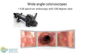 Enhancing the Quality of Colonoscopy