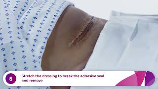 AAA Surgical C-Section Removal-Application